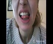 beautiful face, but rotten teeth! from pussy prnstar s
