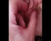 Piercing my wife's vch clit hood from xxx vch