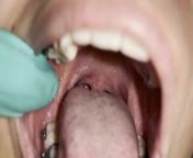 Uvula fetish from mouth thong theeth uvula fetish